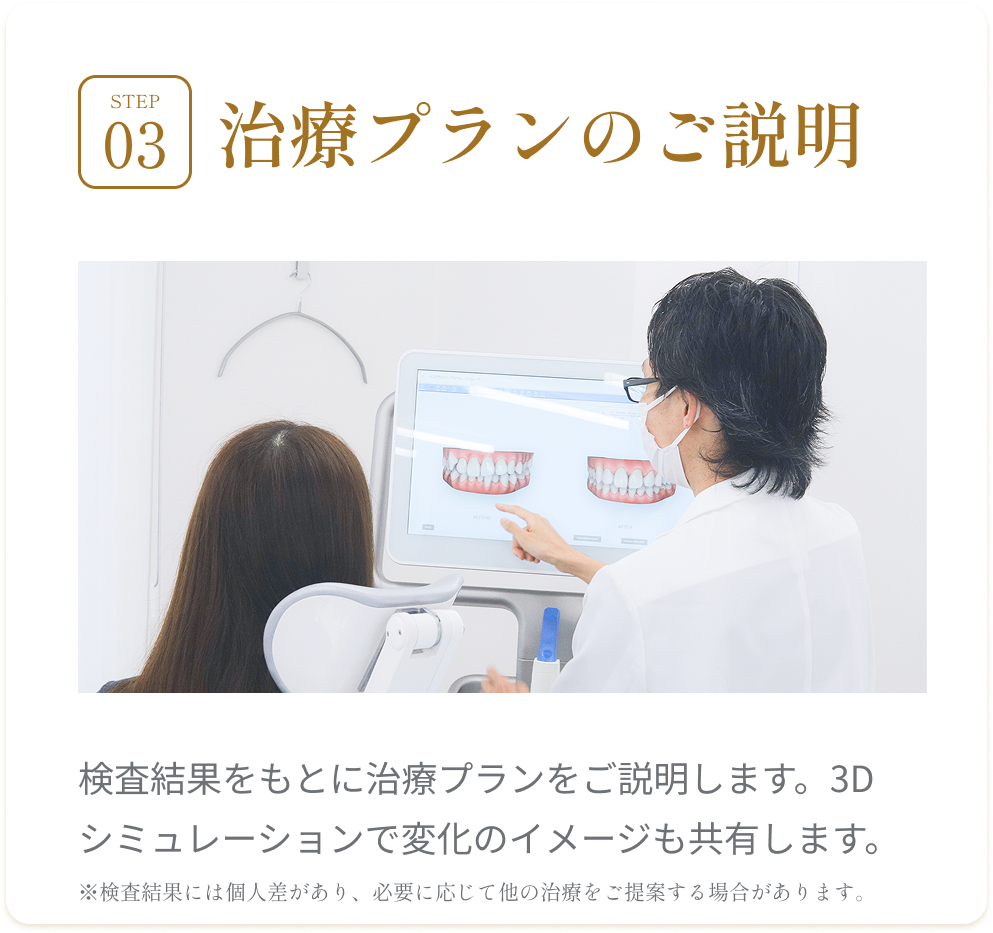 STEP3